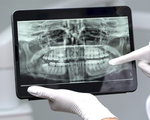 escaner 3d clinica viladent montequinto